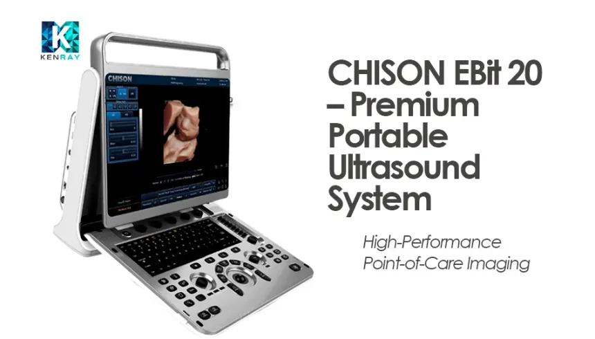 CHISON EBit 20 – Premium Portable Ultrasound System