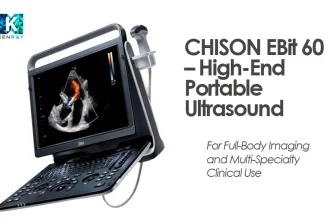 CHISON EBit 60 – High-End Portable Ultrasound
