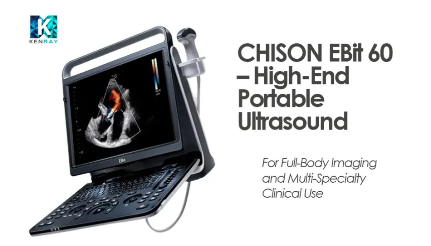 CHISON EBit 60 – High-End Portable Ultrasound