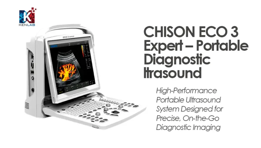 CHISON ECO 3 Expert – Portable Diagnostic Ultrasound