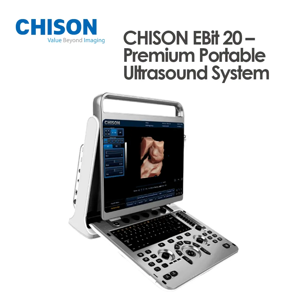 CHISON EBit 20 – Premium Portable Ultrasound System
