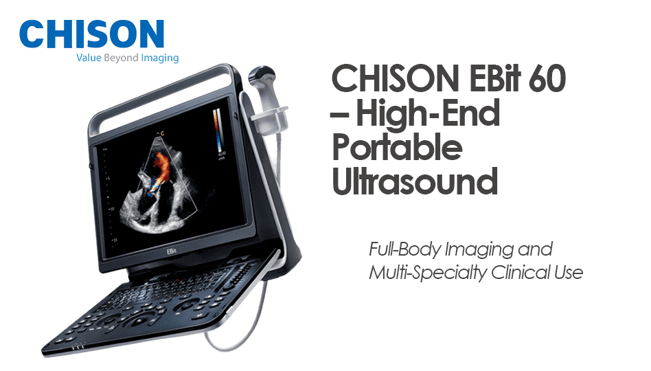 CHISON EBit 60 – High-End Portable Ultrasound