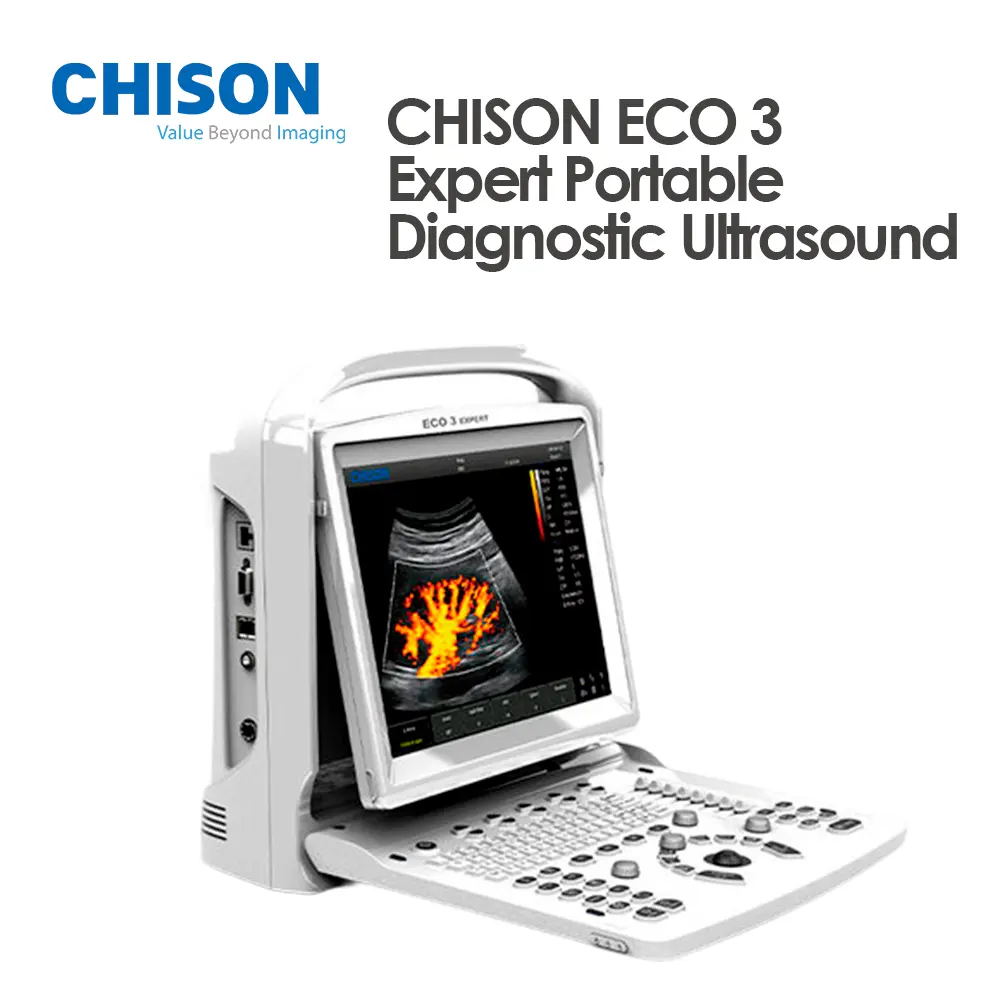 CHISON ECO 3 Expert Portable Diagnostic Ultrasound